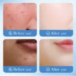 Acne Patches(36dots) NO.SD09630 (SDO) - Image 3